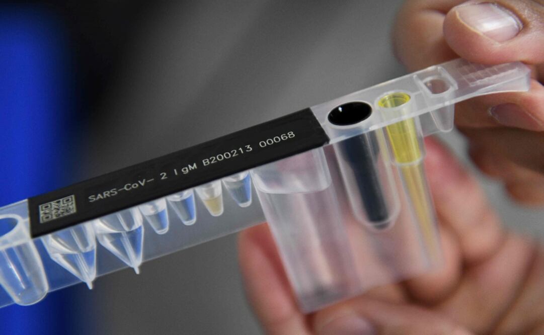 This photo taken on April 9, 2020 shows a COVID-19 coronavirus antibody test kit - Photo: Greg Baker/AFP