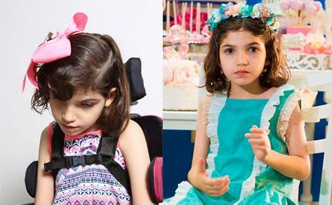 Grace: one year after starting treatment with Cannabidiol oil