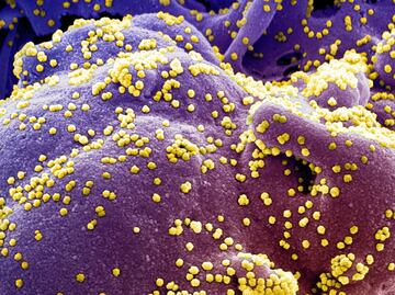 Detectan nueva cepa "agresiva" y "contagiosa" del coronavirus en Ucrania