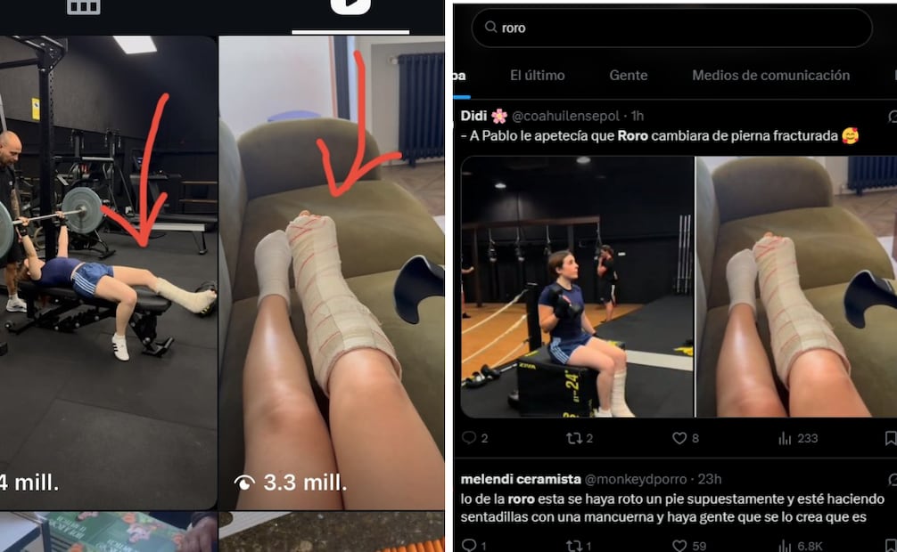 Pese al anuncio, la conversación tomó otro rumbo cuando algunos seguidores notaron una aparente incongruencia: en un video se muestra con el yeso en la pierna derecha, pero en otra grabación aparece entrenando con la pierna izquierda enyesada.
Foto: Captura de pantalla en redes sociales.