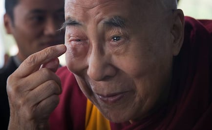 El Dalái Lama es tratado de la próstata en EU