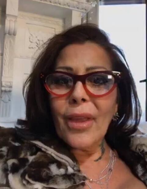 ¿Qué le pasó al rostro de Alejandra Guzmán?