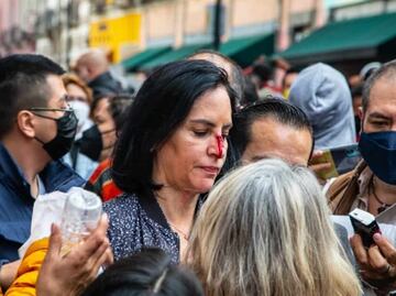 Golpeada y sangrando, Lía Limón denuncia agresión afuera del Congreso CDMX