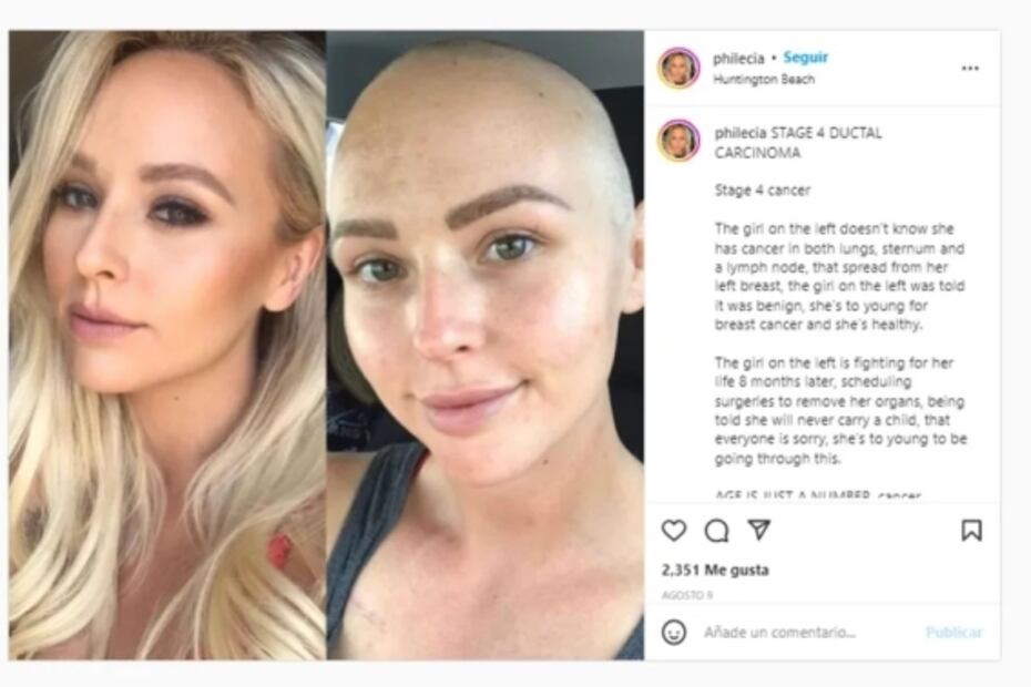 “Tuve miedo de perder mi vida”: mujer comparte experiencia tras mal diagnóstico de cáncer etapa 4