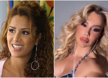 Ninel Conde presume labios voluptuosos y desata las críticas