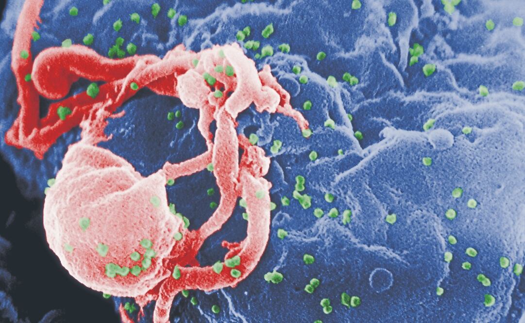 Liberación del VIH (en verde) en un cultivo de linfocitos. Foto: de C. Goldsmith Content Providers CDC C. Goldsmith, P. Feorino, E. L. Palmer, W. R. McManus