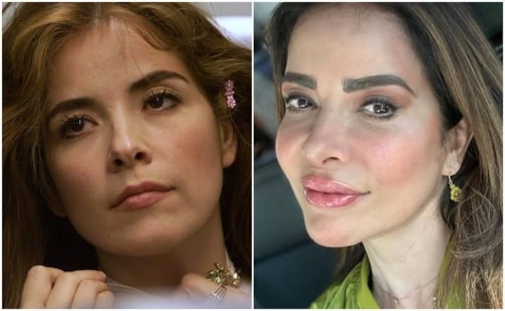Critican labios de Gloria Trevi, le piden que ¡le pare al bótox!