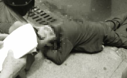 Balean en la cabeza a automovilista en la colonia Del Valle