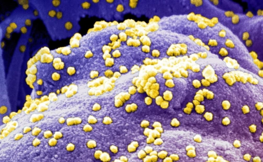 Proteína pico del coronavirus puede causar por sí sola daños pulmonares