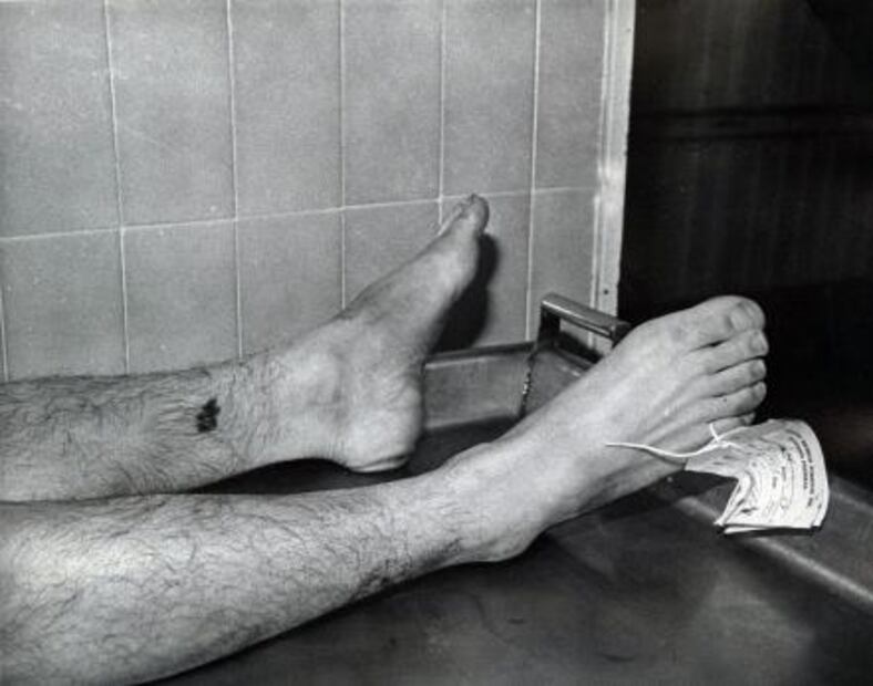 Cuando las morgues recorrían la ciudad