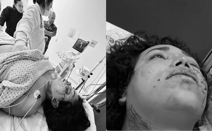 Paola Suárez a punto de perder el ojo y con dos costillas rotas tras golpiza de su prometido