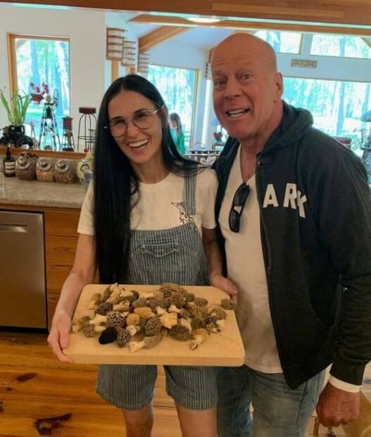Bruce Willis: Expertos explican en qué consiste la enfermedad neurodegenerativa que padece el actor