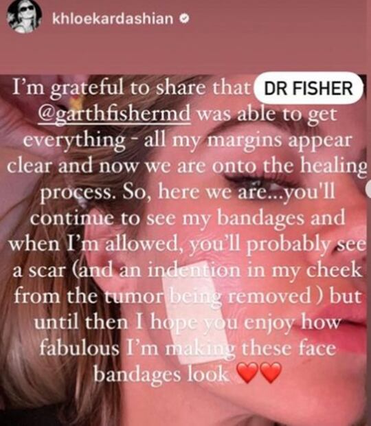 Khloé Kardashian, su diagnóstico de cáncer en la piel: todo lo que sabemos 