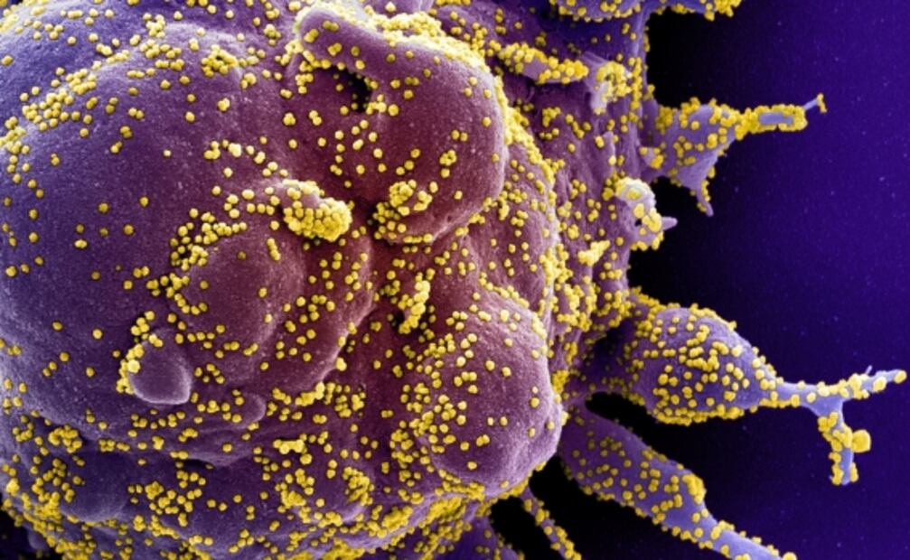 Genes neandertales pueden aumentar riesgo de Covid-19 grave: estudio