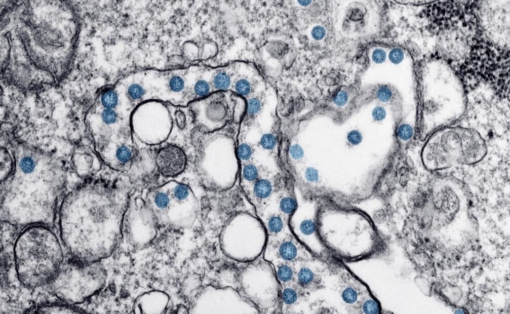 Crean el mapa genómico más preciso y completo del coronavirus SARS-CoV-2