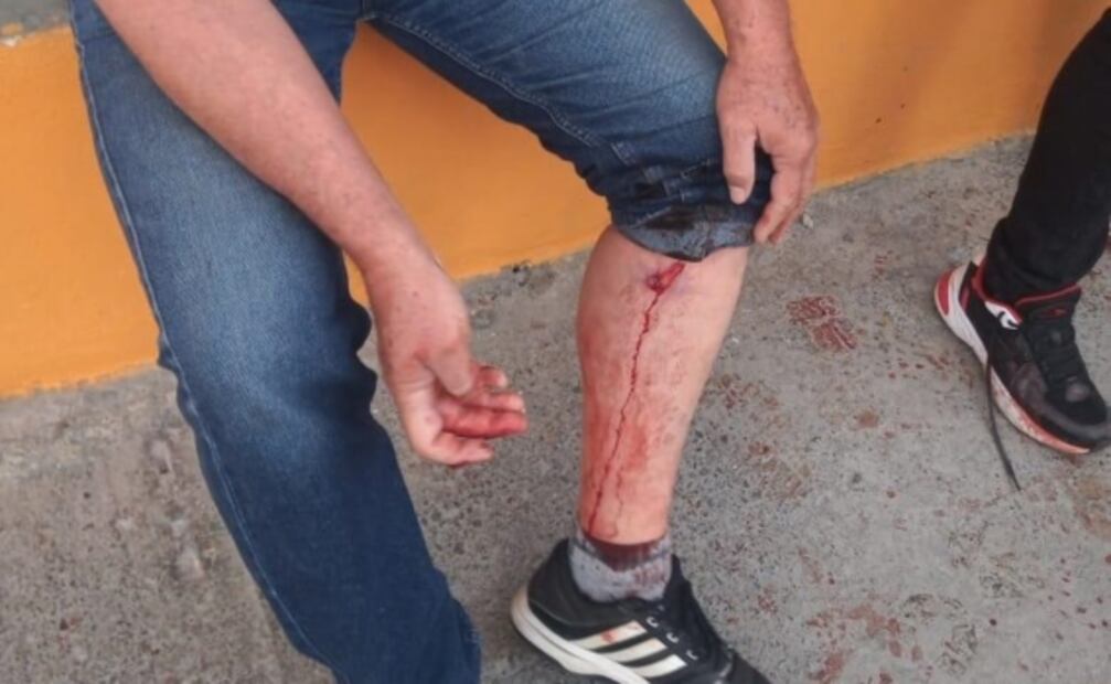 Ladrón asalta cocina económica y mata a un comensal; vecinos de Tecámac lo persiguen y lo linchan