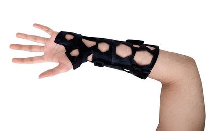Could 3D printing replace plaster casts?