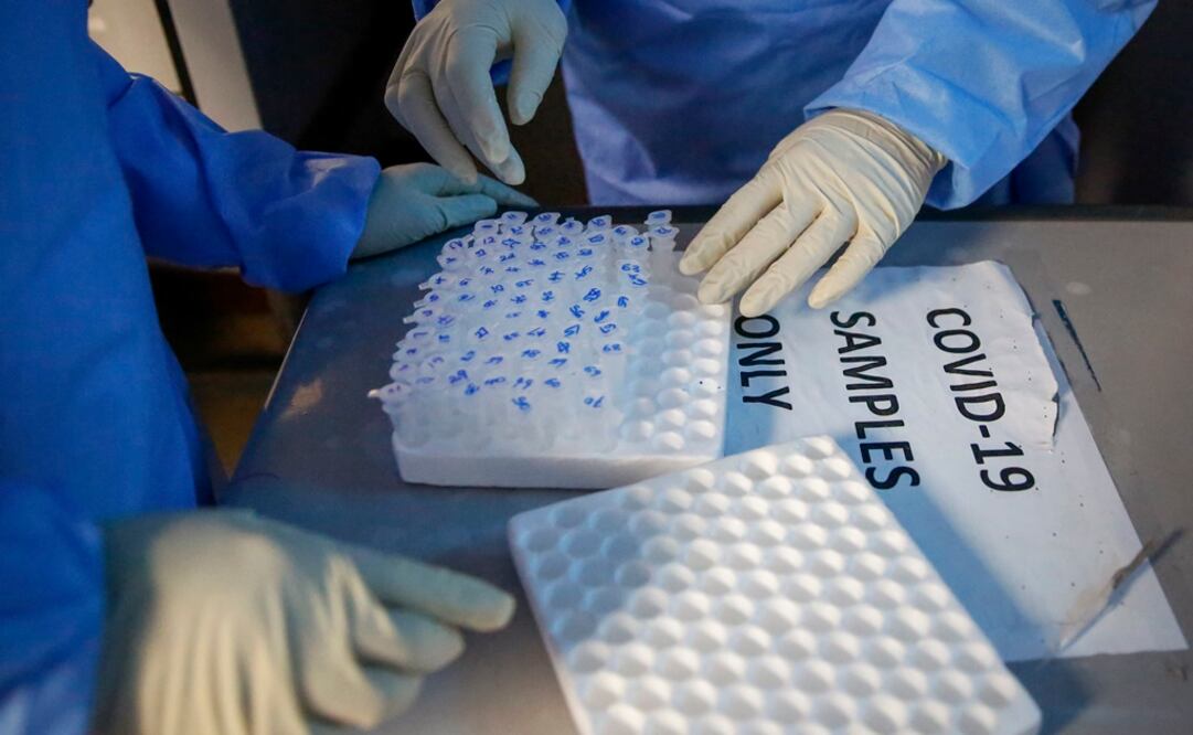 Laboratory technicians handle microcentrifuge tubes containing patient samples to be tested for the new coronavirus that causes COVID-19 - Photo: Brian Inganga/AP