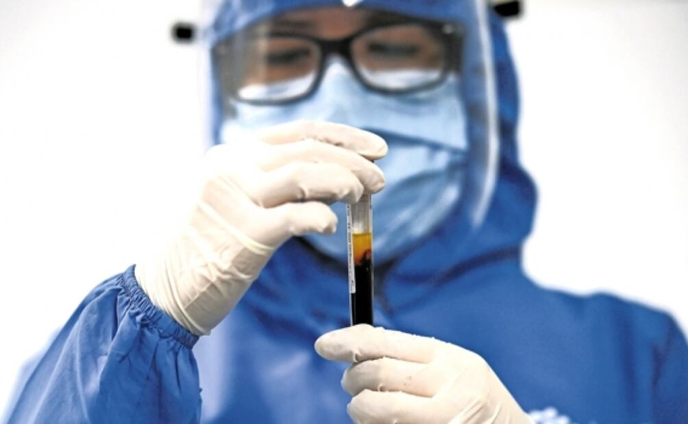 Anticuerpos del Covid-19 duran, al menos, tres meses: estudio en sangre y saliva