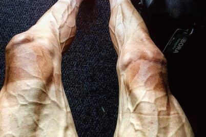 Desgaste se acentúa en el alto rendimiento