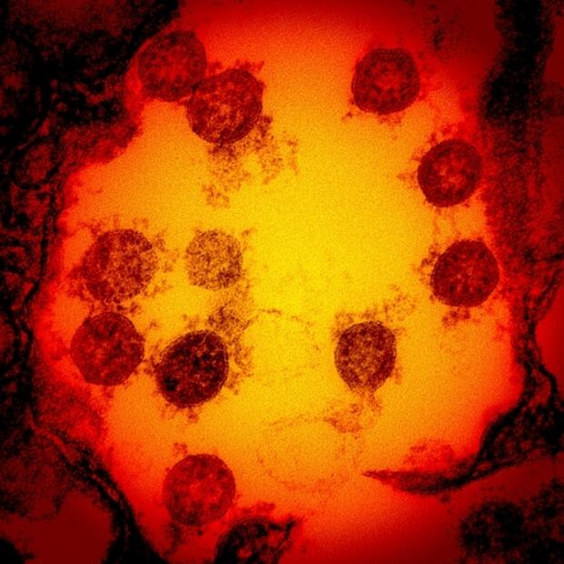 Técnicas de imagen en 3D reconstruyen la "llave" del coronavirus