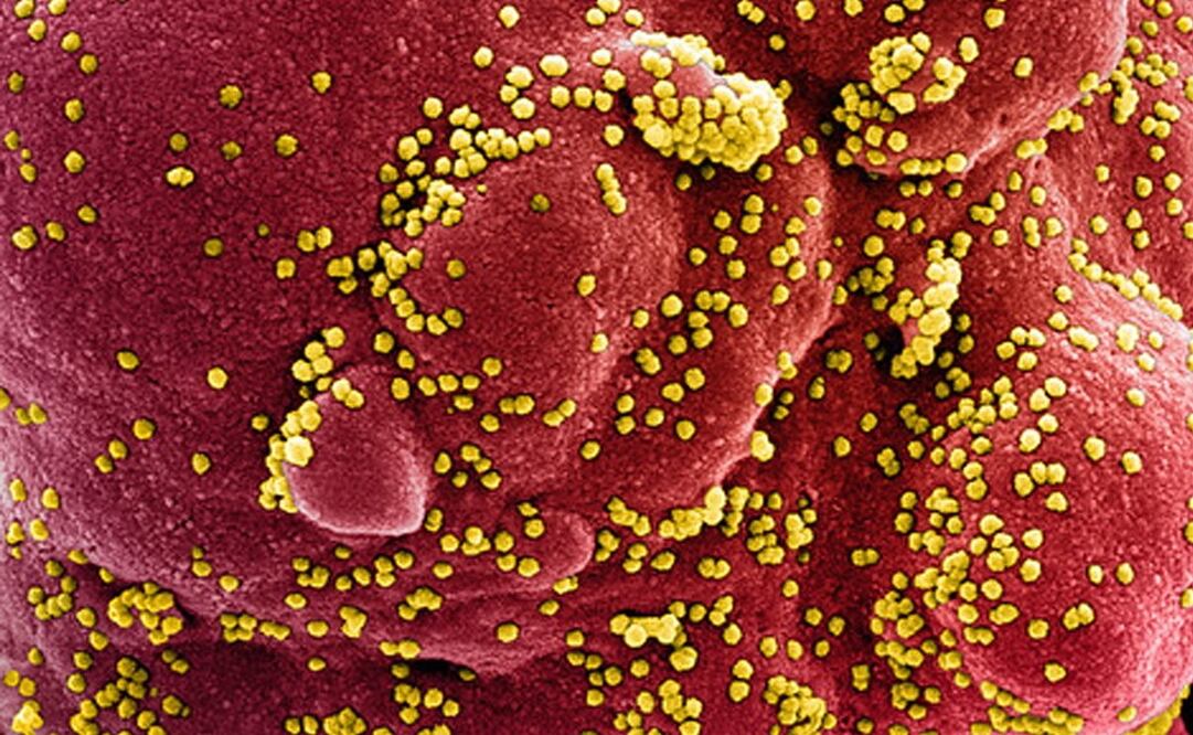 Foto: EFE/EPA/NIAID/NATIONAL INSTITUTES OF HEALTH HANDOUT 