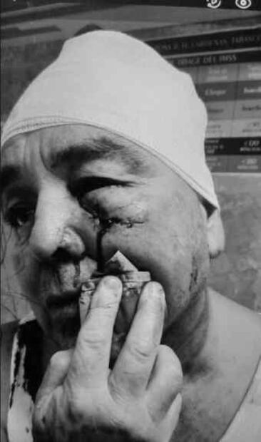 Profesor agredido Foto: Especial