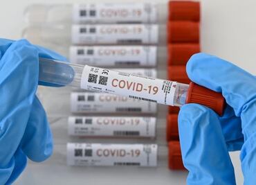 Repuntan casos de Covid-19 en Guanajuato