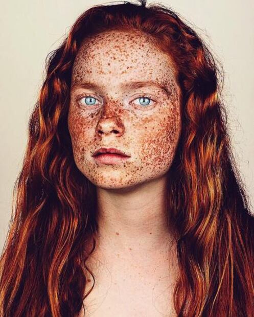 Este fotógrafo retrata a personas con pecas y se viraliza
