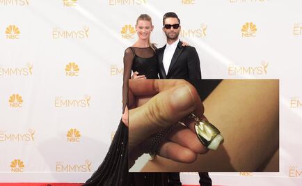 Modelo hace collar con su muela del juicio