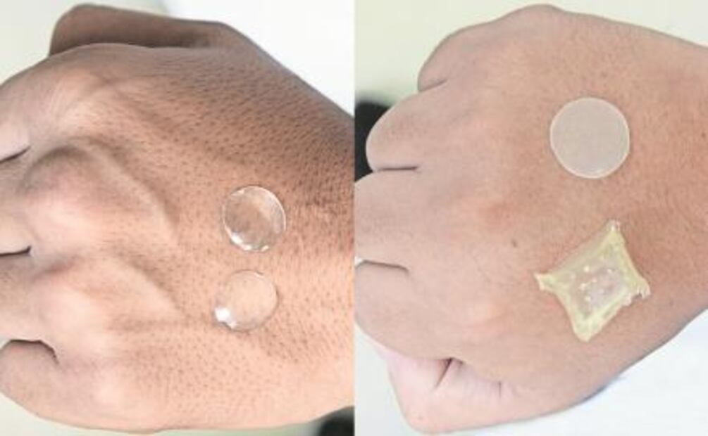 Parche transdérmico para combatir las dislipidemias