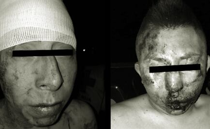 Frustran linchamiento de presuntos secuestradores en Tecámac