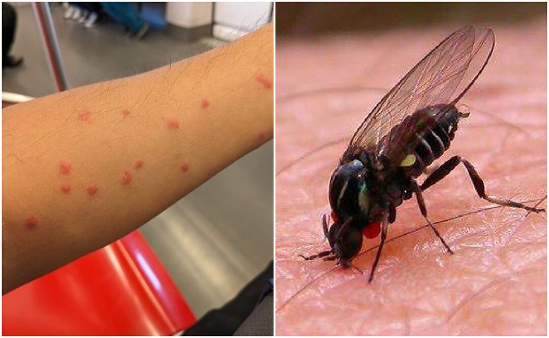 Picaduras de mosquitos en Nuevo León
Foto: Captura de pantalla