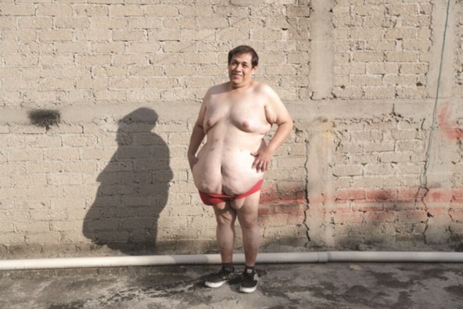 "Si quería hacer el cambio (de sexo) tenía que bajar de peso"