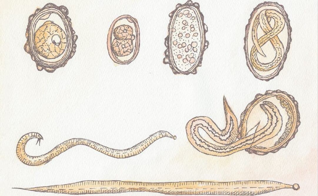 Foto: Ascaris lumbricoides (ESPECIAL)