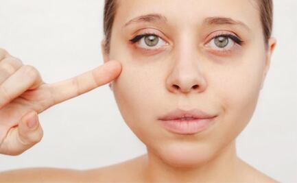 Así es como el yoga puede terminar con tus ojeras