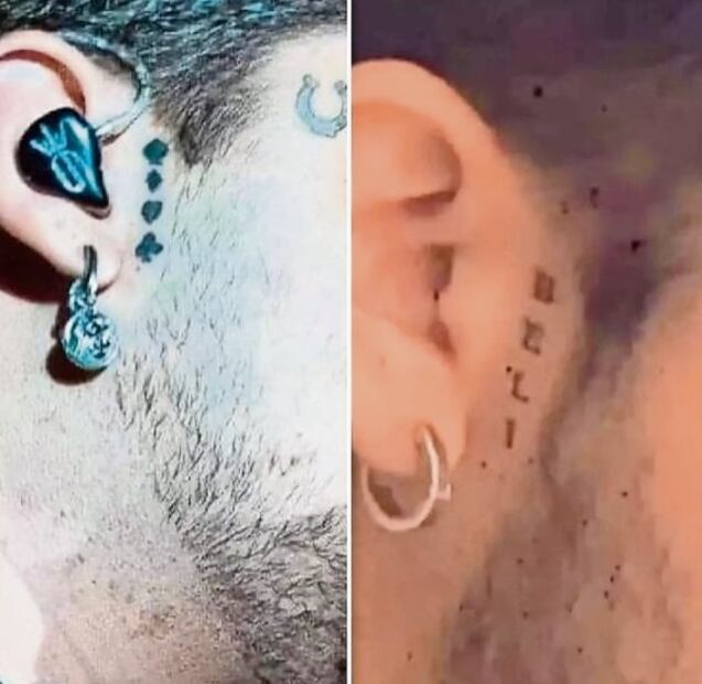 ¿Qué es más perjudicial para la salud, tapar un tatuaje o removerlo? 