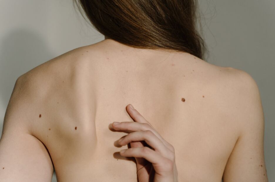 Imagen: BioAgnes