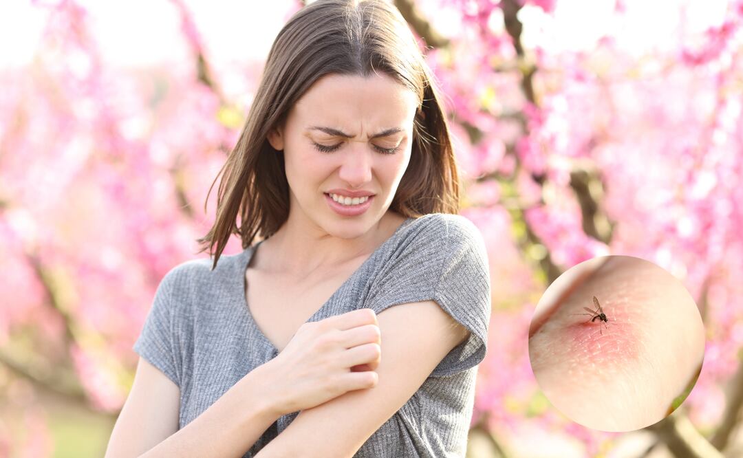 Estos aromas naturales alejan a los mosquitos sin usar químicos y de forma efectiva.
Foto: El Universal