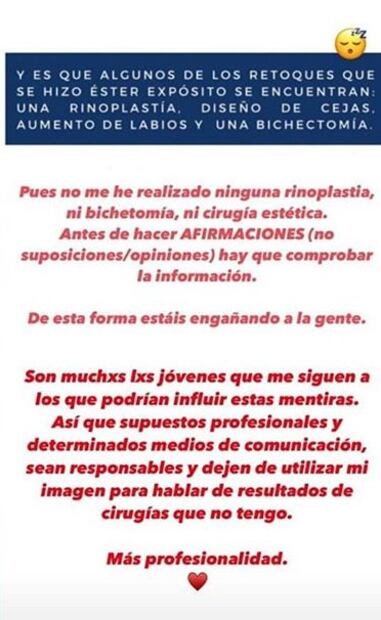 Ester Expósito impacta con foto; asegura no tener cirugías estéticas