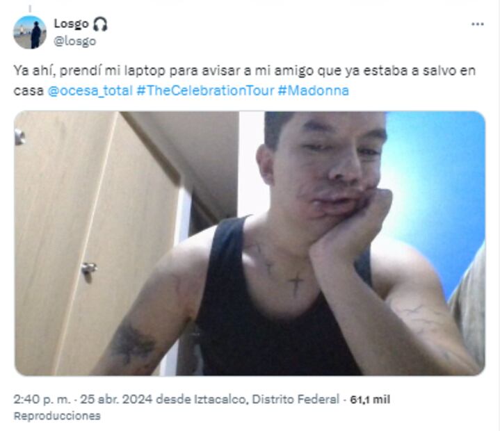 Joven denuncia agresión física por parte de policías en concierto de Madonna. Fotos: Captura de pantalla