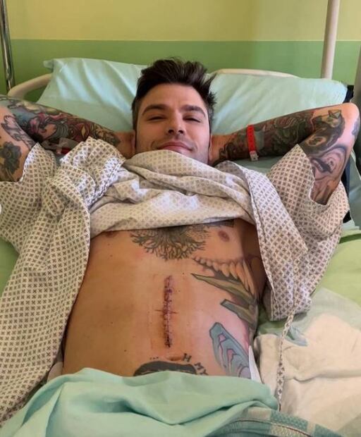 El rapero Fedez se somete a 6 horas de cirugía; le extirpan un tumor en el páncreas