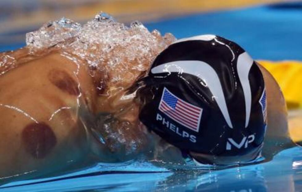 Michael Phelps y los círculos morados en la espalda