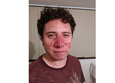 Agreden a vocero de los damnificados en el multifamiliar de Tlalpan