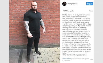 Actor de "Game of Thrones" revela que padece parálisis facial 