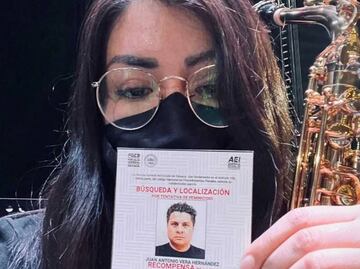 Saxofonista quemada con ácido alerta de que su agresor puede salir libre hoy