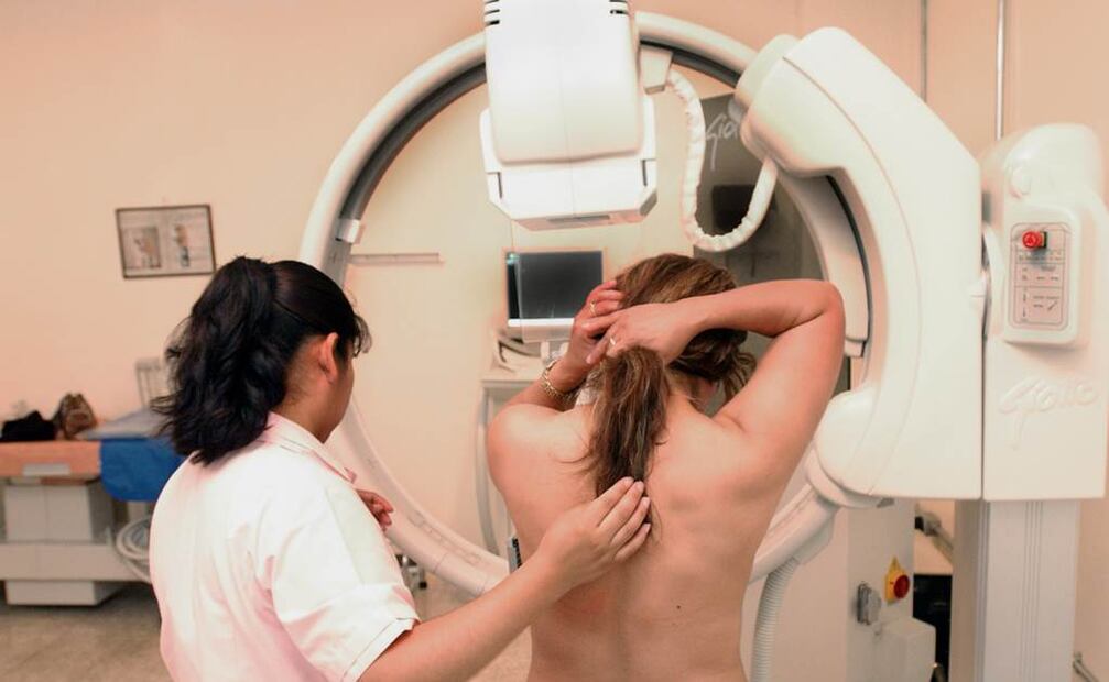 La detección del cáncer fue 1,5 veces mayor. Foto: Archivo