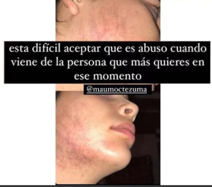 Paula, hija de Mariana Levy, aclara que sufrió violencia de expareja 