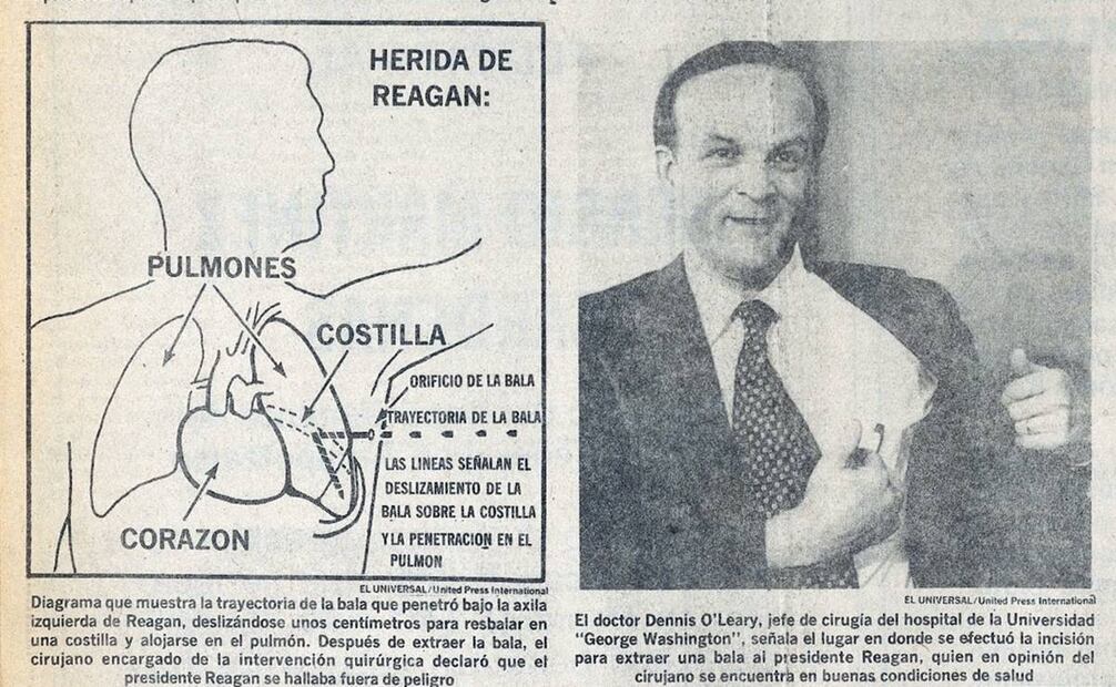 Esta infografía de la época indica la trayectoria de la bala en el cuerpo del jefe de Estado. A la derecha, el portavoz del hospital que lo atendió explica a los medios la herida y la cirugía que requirió. Hemeroteca EL UNIVERSAL.