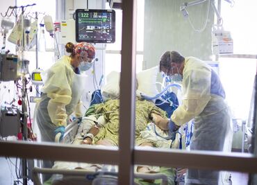 ¿Tuviste Covid-19 grave? Puede que estés más protegido ante nuevas variantes